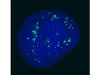 CBX4 Antibody