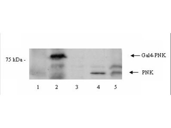 PNKP Antibody