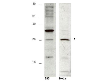 HUS1B Antibody