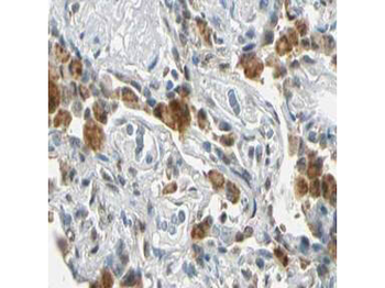 FANCG Antibody