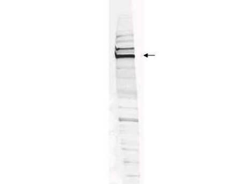 WRNIP1 Antibody
