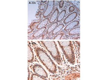 AURORA KINASE B phospho T232 Antibody