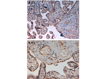 AURORA KINASE B phospho T232 Antibody