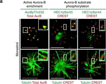AURORA KINASE B phospho T232 Antibody