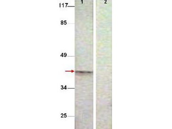 AURORA KINASE B phospho T232 Antibody