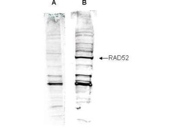 RAD52 Antibody