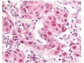E2F1 Antibody