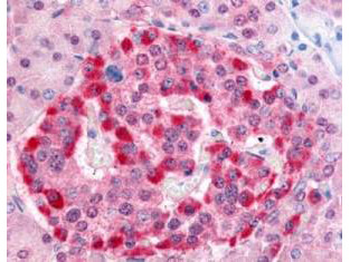 PARK7 Antibody