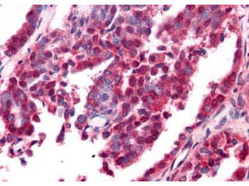 EGR-1 Antibody