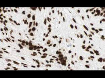 GLI2 Antibody