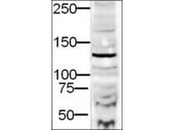 DIA-2 Antibody