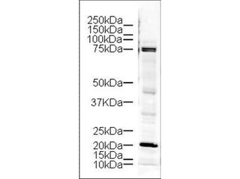 LIMK1 Antibody