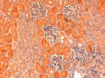 DELTA-1 Antibody