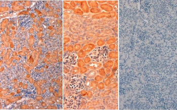 DELTA-1 Antibody