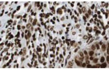 HDAC1 (C-terminus) Antibody
