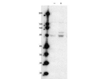 MARK2 phospho T595 Antibody