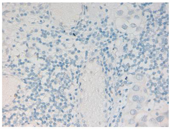 Histone H2AvD phosphoS137 Antibody