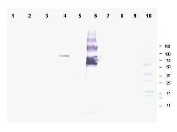 Ankrd26 Antibody