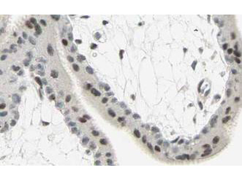 SMAD3 Antibody