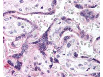 EGFR Antibody
