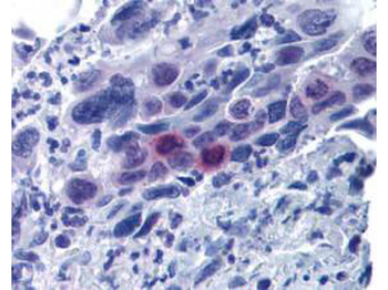 CENPU Antibody