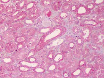 ABCB1 Antibody