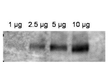 ABCB1 Antibody
