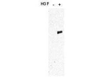 MET Antibody