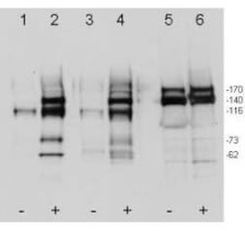 MET Antibody