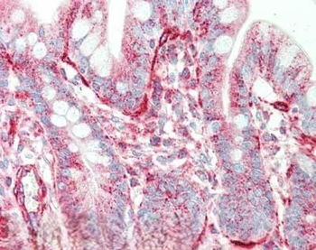 Sipa1 Antibody