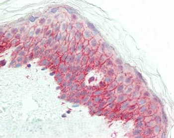 NCOA3 Antibody