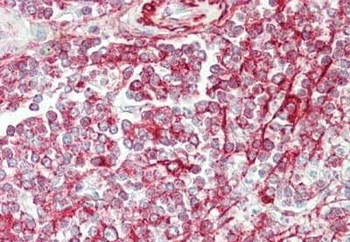 NCOA3 Antibody