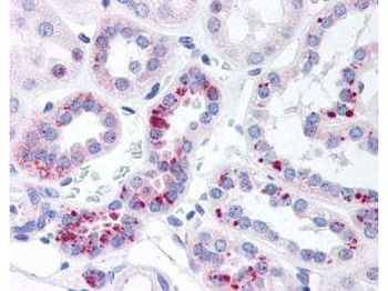 Stat5 phospho Y694 Antibody