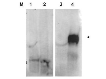 Fibroblast Activation Protein Antibody