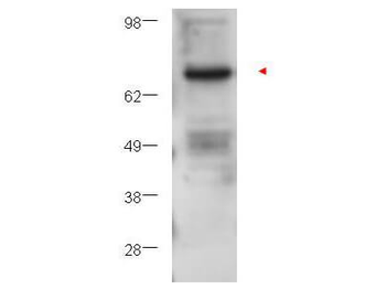 PRKCB Antibody