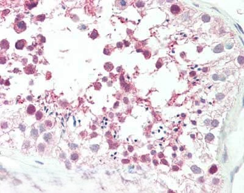 MLF1 Antibody