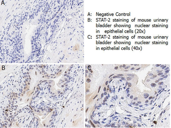 STAT2 phospho Y690 Antibody