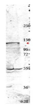 NEDD4 Antibody