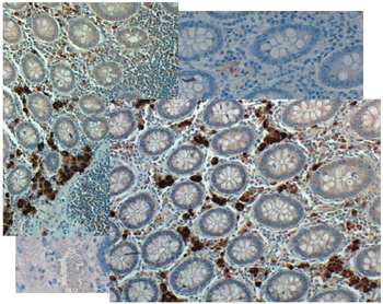 GDF15 Antibody