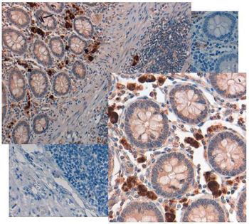 GDF15 Antibody