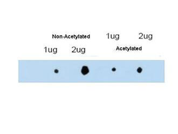 ATDC Antibody