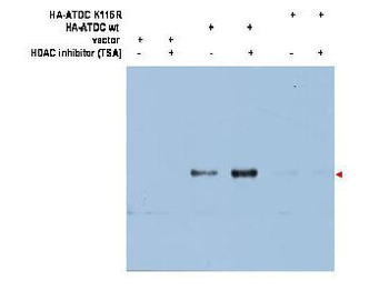 ATDC Ac-K116 Antibody