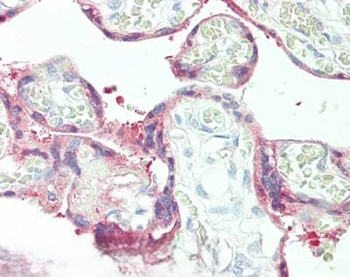 SERPINB2 Antibody