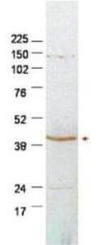 SERPINB2 Antibody