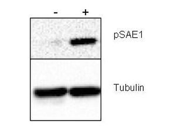 SAE1 phospho S185 Antibody