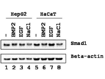 SMAD1 Antibody