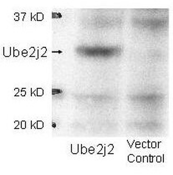 UBE2J2 Antibody