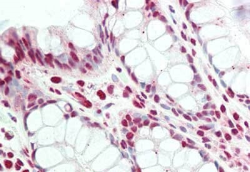 PRDM1 BLIMP1 Antibody