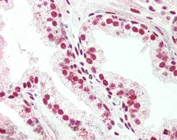 PRDM1 BLIMP1 Antibody