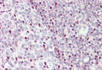 CTCF Antibody